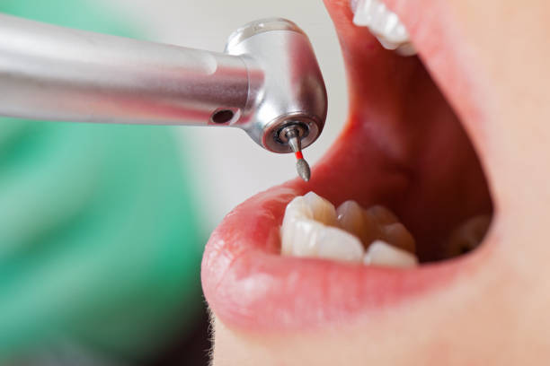 Best Tooth Infection Emergency Dentist  in Ellington, MO